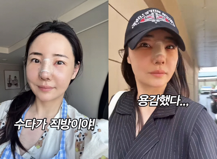 Cho Hye-ryeon, Park Hye-min, thank you for your unexpected beauty after the 3rd nose surgery