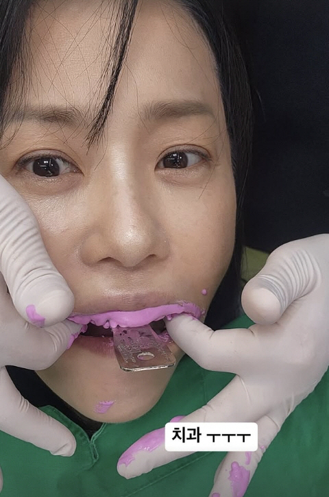  Ko Hyun-jung showed me everything including dental treatment..an easy-going routine in the world
