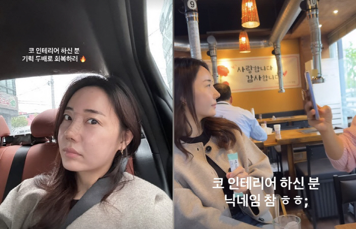Cho Hye-ryeon, Park Hye-min's 3rd nose surgery, and the side line was amazing