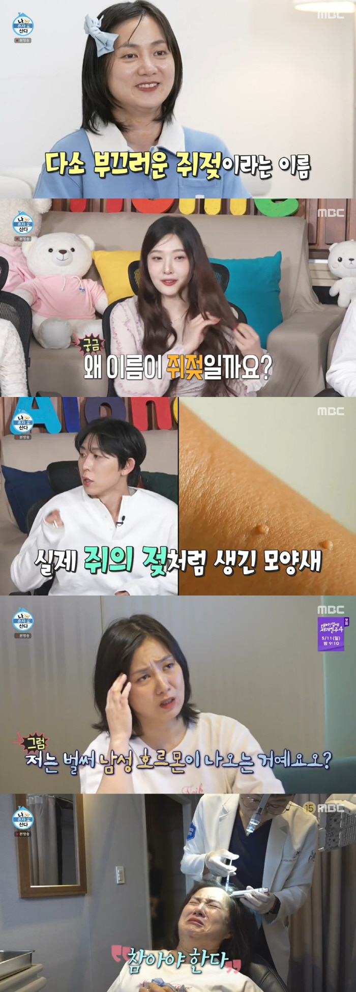 Park Na-rae removed 200 rat milk → I got a hair loss injection. It's shameful (Na Hon-san)