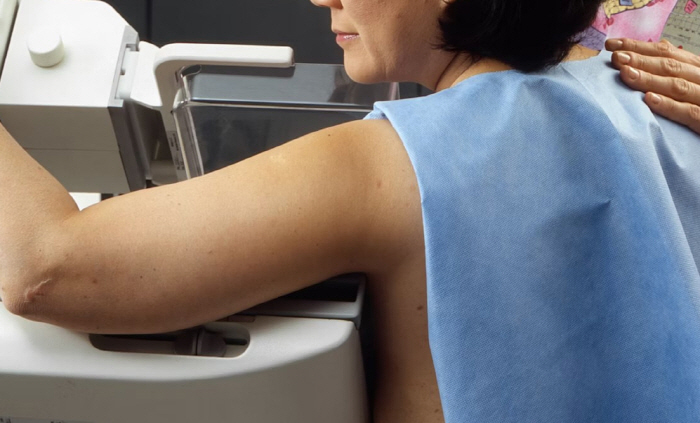 Checklist for self-diagnosis of breast cancer No. 1 in women's cancer