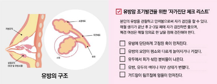 Checklist for self-diagnosis of breast cancer No. 1 in women's cancer