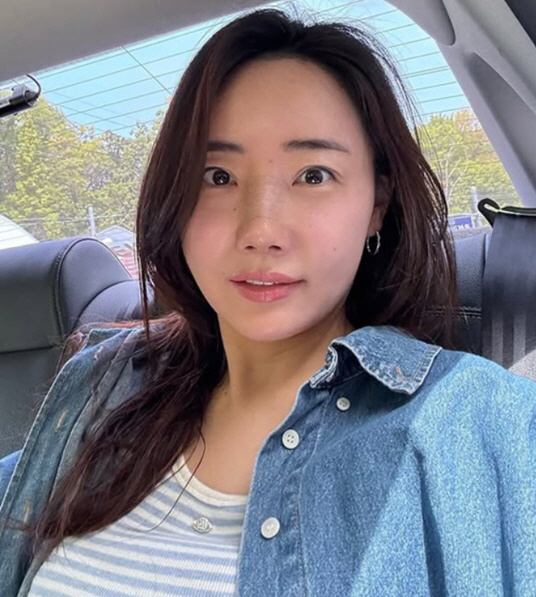 Cho Hye-ryeon, Park Hye-min, added plastic surgery after nose surgery? It's unfair