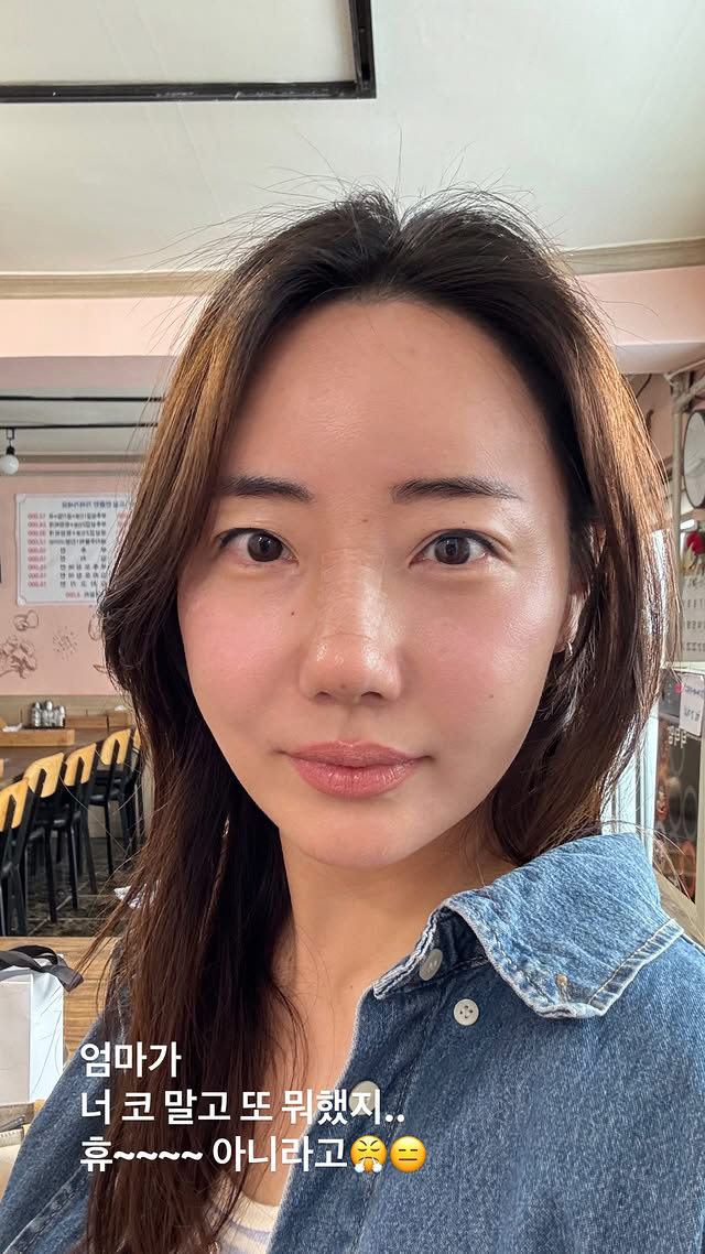 Cho Hye-ryeon, Park Hye-min, added plastic surgery after nose surgery? It's unfair