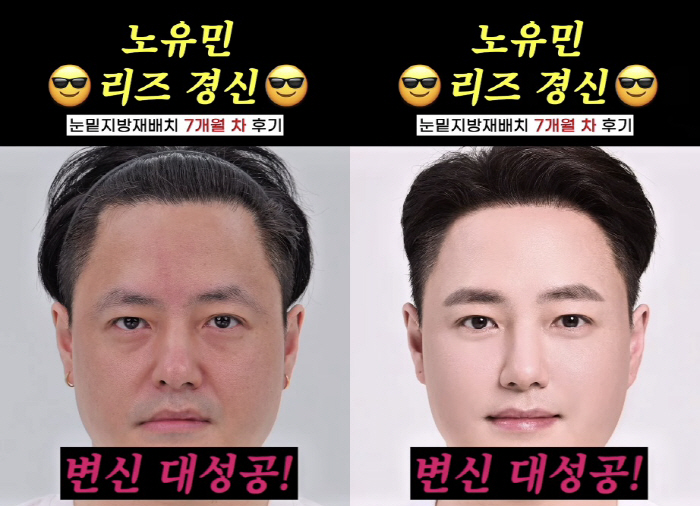 No Yu-min, you sold coffee and you became a building owner..Redevelopment of Liz with Under-Eye Fat  Hair Loss Treatment