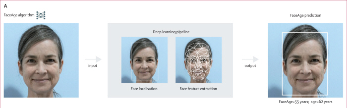 Research team develops biological age and cancer prognosis analysis AI technology through face recognition and deep learning