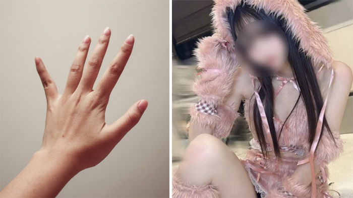 I can't marry another woman...The woman who cut her ring finger off her boyfriend, she cut it off, too