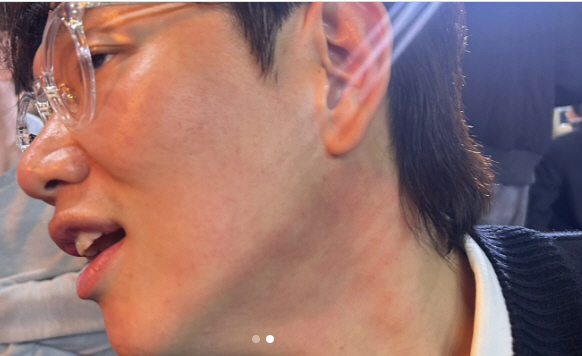 Jang Sung-gyu, I can't believe I got slapped in front of him at the age of 43