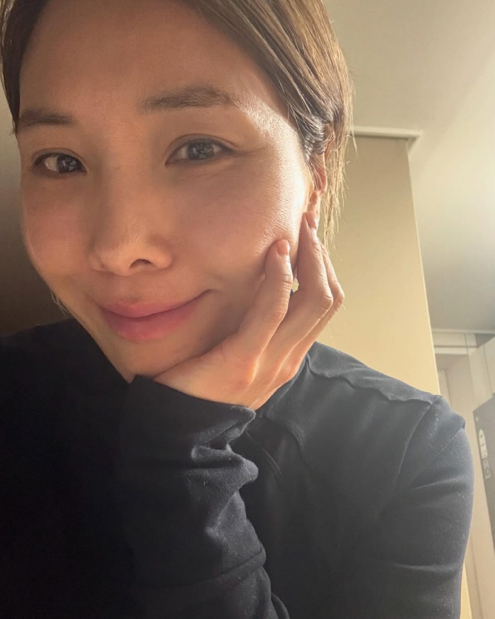 11kg weight loss Shin Bong-seon, the secret to a completely changed face is dermatological laser treatment (Sudol)