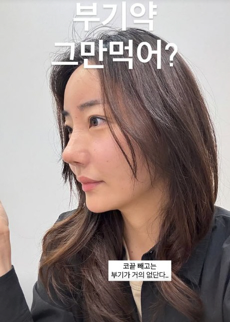 Cho Hye-ryeon, Park Hye-min, failed in the second round of nose surgery, which she was satisfied with