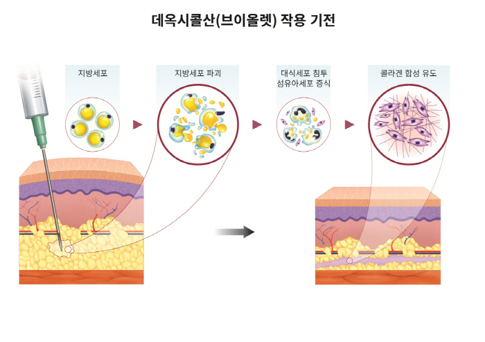 Daewoong Pharmaceutical's fat-destroying injection VOLET is effective on forearms Domestic research team announces SCIE journal