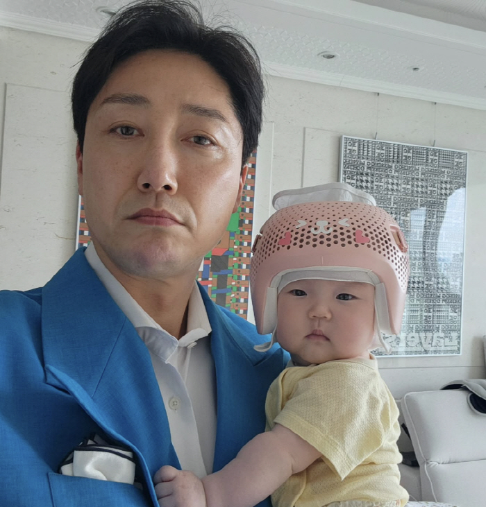 Son Heon-soo put a head correction helmet on his daughter on the 157th day of age My heart is breaking