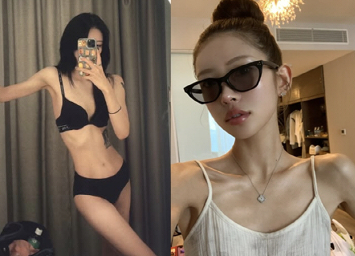 Choi Jin-sil's daughter Choi Jun-hee is only 23 years old, but she's sad about her pelvic necrosis