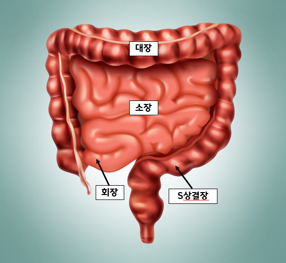 Hallym University Dongdong Elastic Heart Hospital succeeded in connecting the ileum colon under the guidance of ultrasound endoscopy for the first terminal cancer patient in Korea