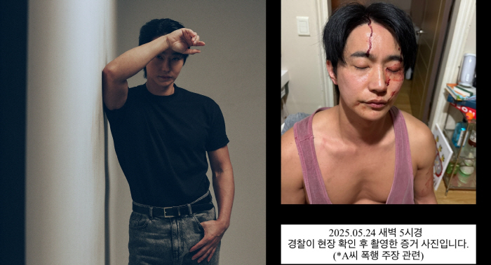 Actor Jeon Ho-joon refuted the allegation of assault on his ex-girlfriend..Please save me. A clear picture of the bloodstains will be revealed. 