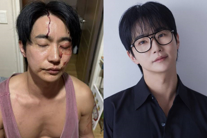  Jeon Ho-joon opened his mouth about assaulting his girlfriend  sexually transmitted disease...Self-defense, self-defense, restraining trespassing