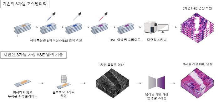 With 3D and virtual dyeing technology, cancer tissue can be observed without incision