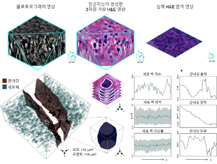 With 3D and virtual dyeing technology, cancer tissue can be observed without incision