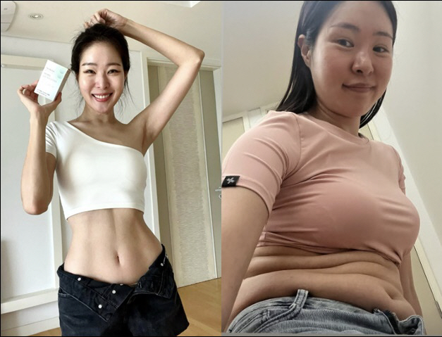 Kim Tae-hyun ♥ Mija, where's the 11-shaped abs…The shock of revealing belly fat