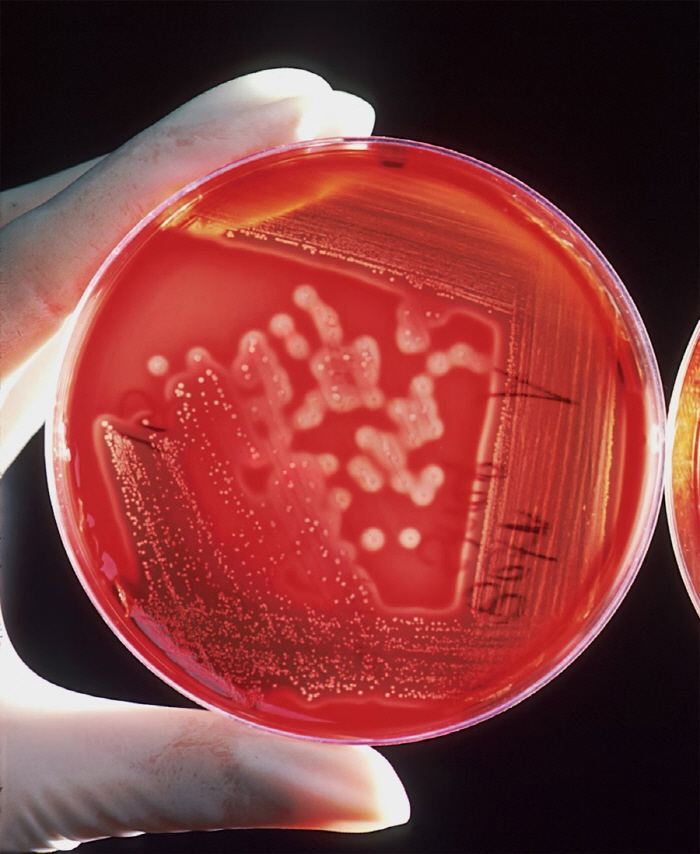 I've been suffering from sinusitis for 7 years because of my boyfriend's fart...E. coli detected in the nose