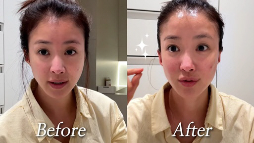 Lee Si-young, did you get plastic surgery..My secret is losing 5kg a month  massage