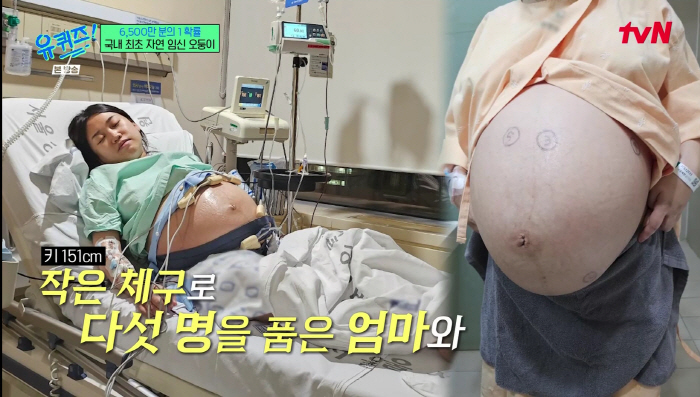 Odong cries every day due to economic fears of natural pregnant couples, and hospitals also recommend selective miscarriage (Uquiz) 