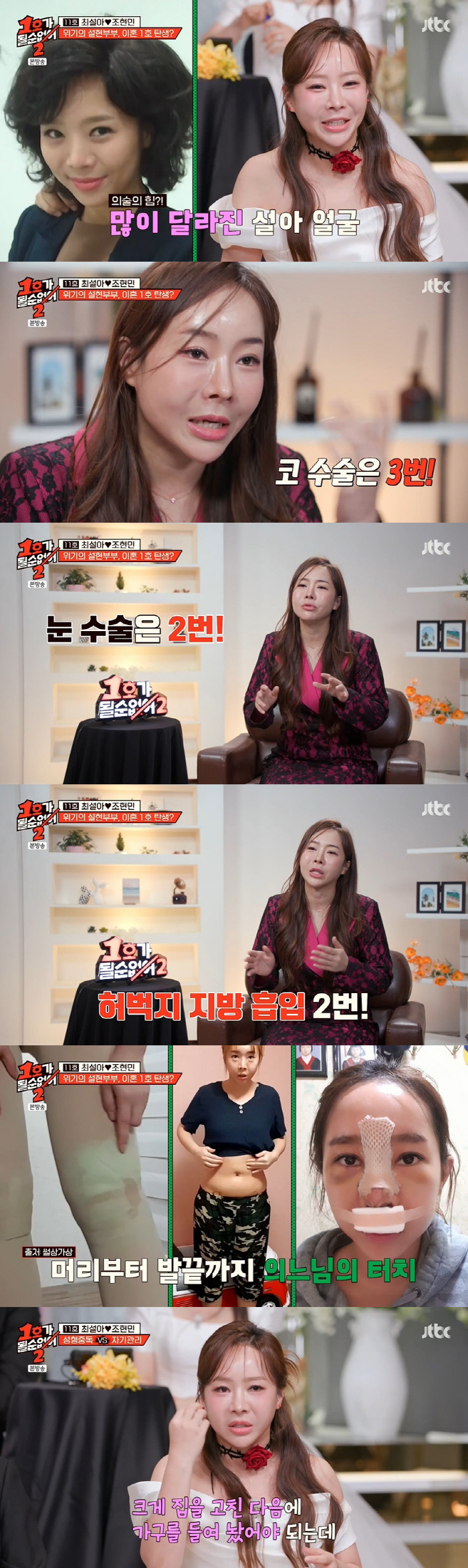 Choi Seol-ah confesses to serious plastic surgery addiction No. 3 X eye surgery No. 2 and inhalation No. 2 of lower abdomen and thigh fat (No. 1)