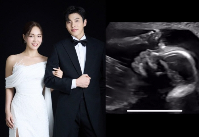 Lim Jung-hee ♥ Ballerino Kim Hee-hyun is visiting a baby angel after 1 year and 7 months of marriage