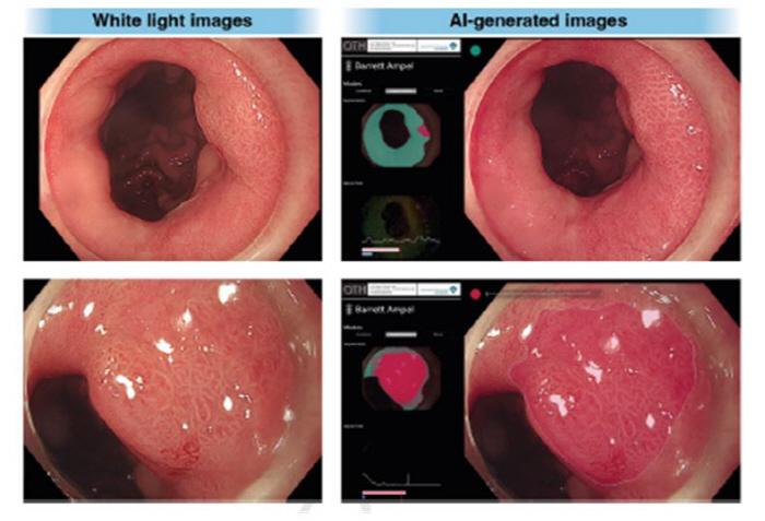 Evolving Healthcare AI...Extend beyond diagnosis to endoscopic assistance and risk prediction