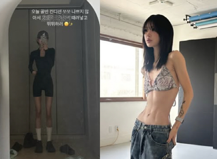 Choi Jin-sil's daughter, Choi Jun-hee, is only 23 years old, but she is sad about the progress of pelvic necrosis
