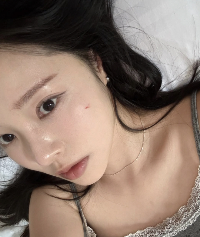 Park Sung-kwang ♥ Lee Sol is facing another facial injury after fighting cancer...My family is worried