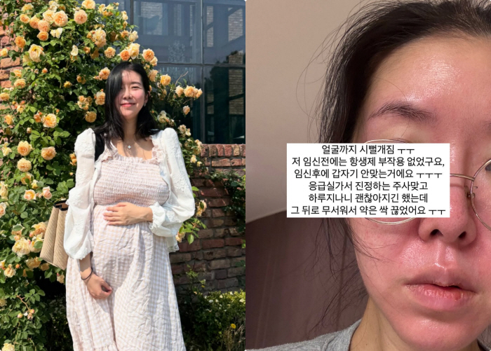 Twin pregnancy Kim Ji-hye, another side effect of antibiotics in the emergency room a month after the fall, is not easy to conceive
