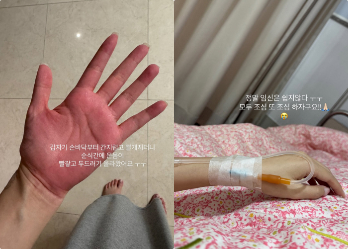 Twin pregnancy Kim Ji-hye, another side effect of antibiotics in the emergency room a month after the fall, is not easy to conceive