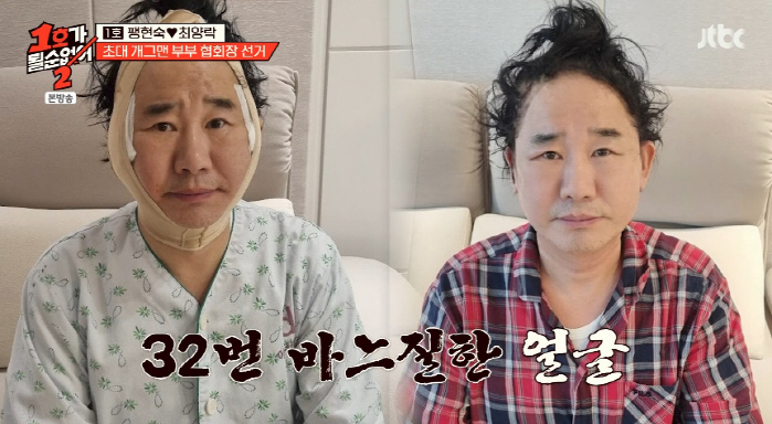 Choi Yang-rak, double eyelid surgery twice + facial colossus..Plastic surgery addiction level (No. 1)