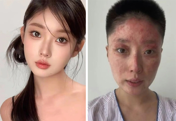 Gas explosion with father's cigarette...It's not a video-released beauty influencer show.