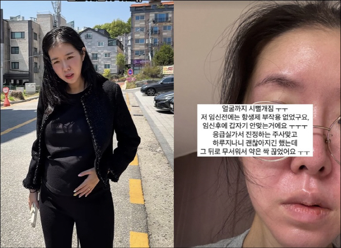 Kim Jihye took medicine during pregnancy and had no side effects in the emergency room