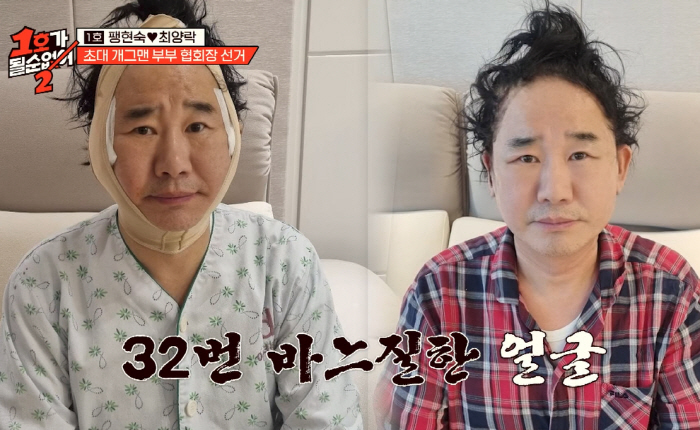 63-year-old Choi Yang-rak had a face-off with his eye surgery twice + facial expression (No. 1) 