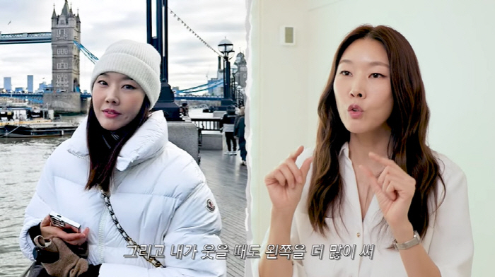 Han Hye-jin's face was twice as thick as both cheeks that changed significantly after acupuncture surgery (Han Hye-jin)