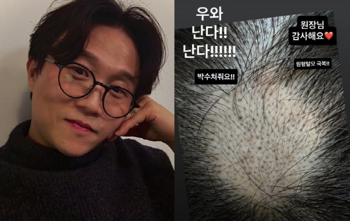 Lee Sol ♥ Park Sung-kwang burst at the hospitalMiraculous treatment results overcome circular hair loss!