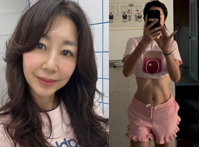 Yoon Jong-shin ♥ Jeon Mi-ra gave birth three times, giving birth to three deformed abdominal muscles, and getting better