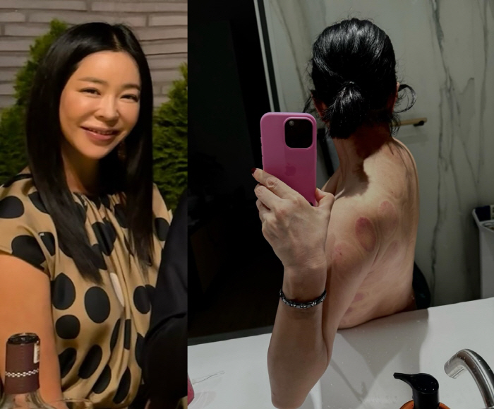 Lee Hye-young was surprised to see you without your top...What happened? It's full of scars