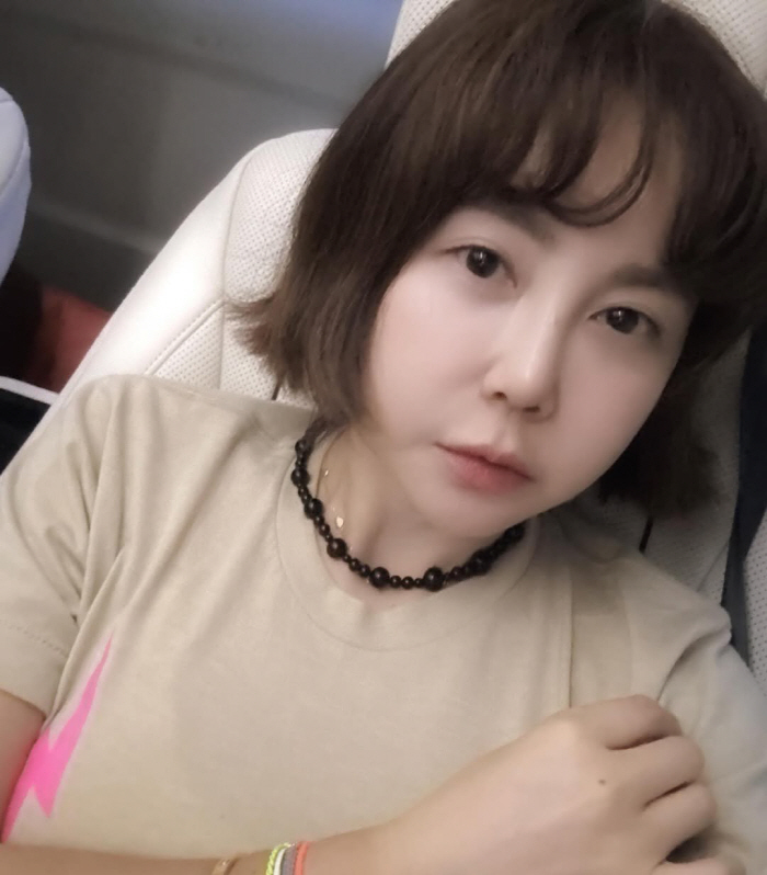 Hwang Hye-young is angry..If I gain weight, I get filler. If I lose weight, I cut my chin?