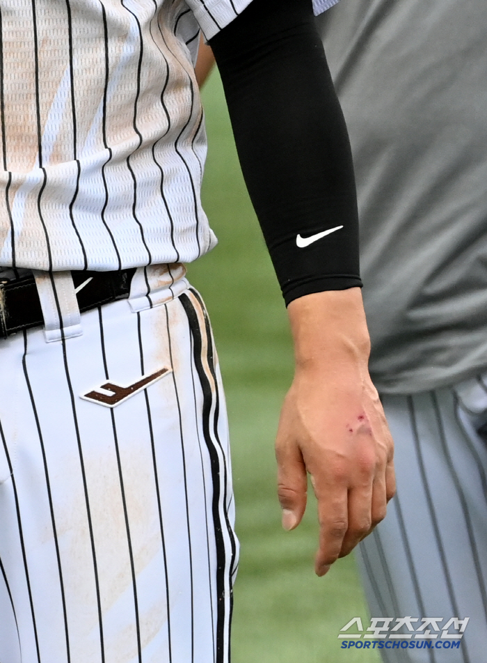 Koo Bon-hyuk was replaced after being hit by a pitch on the back of his left hand. a sigh of relief. There's nothing wrong with the X-ray check-up bone