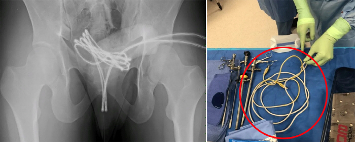 1m long USB cable, college student in genital...The reason is absurd