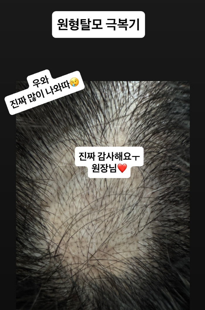 Lee Sol ♥ Park Sungkwang, thank you so much for the good news after 2 years