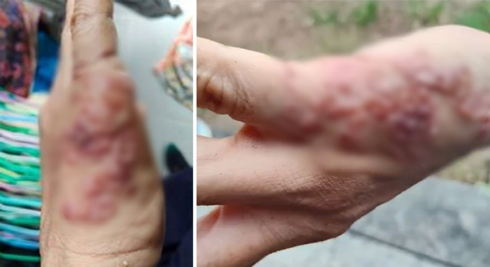 My hands are itchy, wriggling after weeding...Be careful if you keep a dog or cat