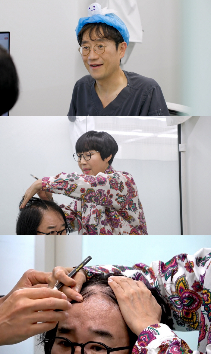 Choi Yang-rak, Shocking Hair Condition...I'll be bald in three years Diagnostics (can't be No. 1)