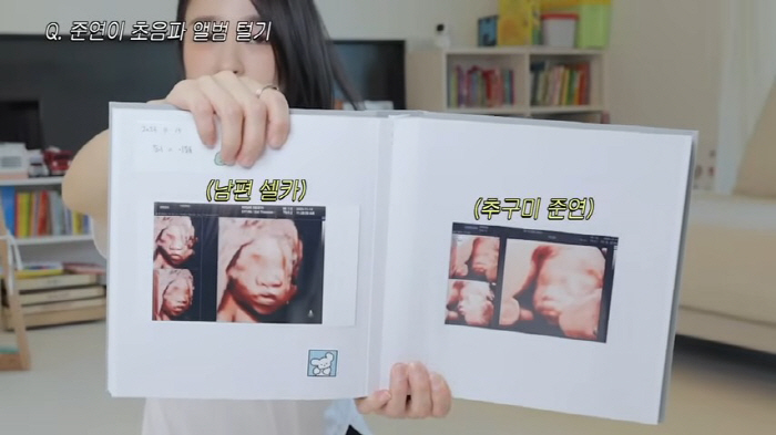 'I don't want to look like my husband for 10 months...Let's take an ultrasound again. '9 years older♥.' Behind the scenes of Son Yeonjae's birth