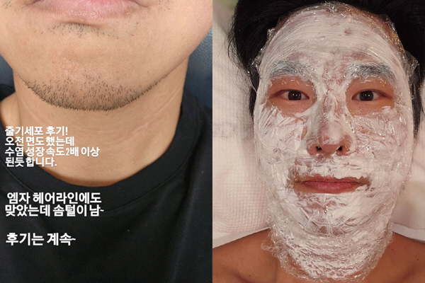 Kim Si-duk's appearance has changed dramatically since the stem cell procedure..'Bear growth rate twice ↑'