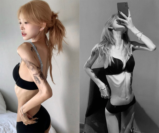 96 → 41 kg Choi Jun-hee, ribs..Give me some money to operate on my chest